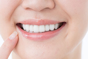 天然歯に近い輝き