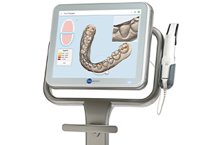 精密検査・3Dスキャン<