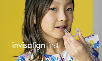 インビザラインファースト