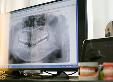 セファロについて