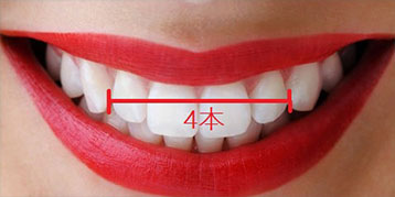 ジルコニアセラミック4本セット