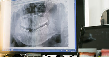 難症例への対応が可能