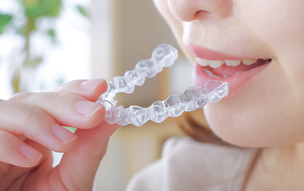 エンジェルアライナーとは？