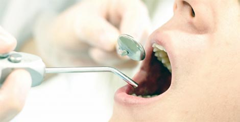 口腔内のチェック