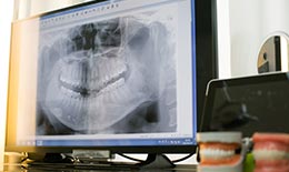 多数の矯正治療症例数。実績と経験はご安心ください