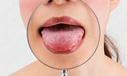 舌癖に好影響を与えることも