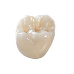 オールジルコニア