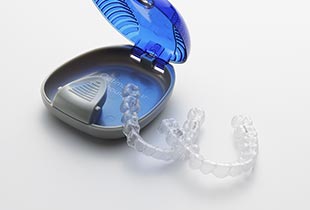 インビザライン部分矯正