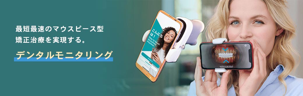 デンタルモニタリング