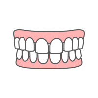 すきっ歯・空隙歯列