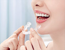 インビザライン