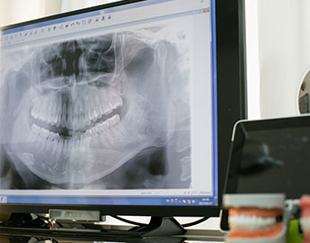 CT撮影で詳細な情報を得ることができます