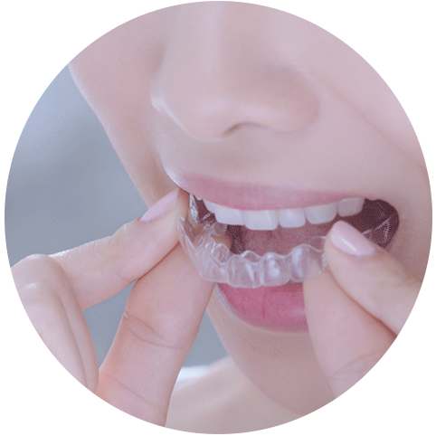 インビザライン装着イメージ