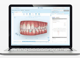 3D治療計画の作成