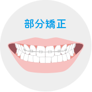 部分矯正