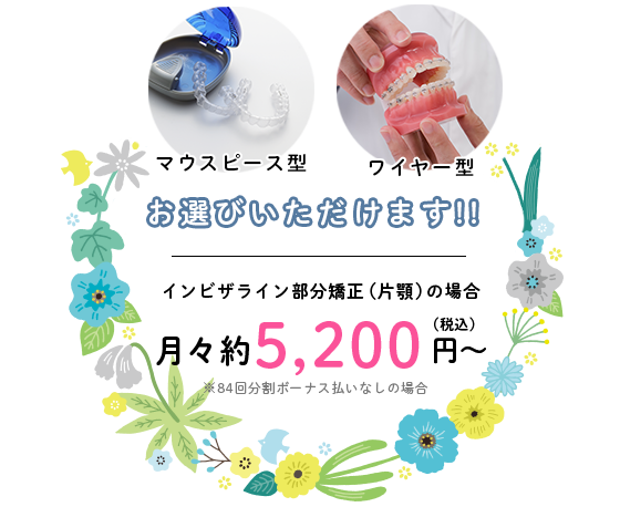 インビザライン部分矯正が月々4800円から