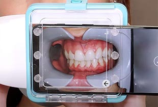 より効果的な治療を実現